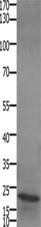 Gel: 10+12%SDS-PAGE, Lysate: 30 μg, Lane: Human liver cancer tissue, Primary antibody: STMN2/STMN3/STMN4 Antibody(STMN2/STMN3/STMN4 Antibody) at dilution 1/450, Secondary antibody: Goat anti rabbit IgG at 1/8000 dilution, Exposure time: 1 minuteRabbit anti-Human STMN2/STMN3/STMN4 Polyclonal Antibody