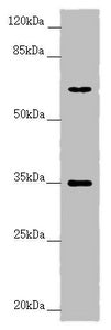 Western blot | All lanes: TRIM23 antibody at 4.55 μg/ml + Raw264.7 whole cell lysate | Secondary | Goat polyclonal to rabbit IgG at 1/10000 dilution | Predicted band size: 65, 64, 62 kDa | Observed band size: 65, 35 kDaRabbit anti-Human TRIM23 Polyclonal Antibody