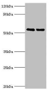 Western blot  | All lanes: TRIM27 antibody at 4µg/ml  | Lane 1: Jurkat whole cell lysate  | Lane 2: HepG2 whole cell lysate  | Secondary  | Goat polyclonal to rabbit IgG at 1/10000 dilution  | Predicted band size: 59, 42 kDa  | Observed band size: 59 kDaRabbit anti-Human TRIM27 Polyclonal Antibody