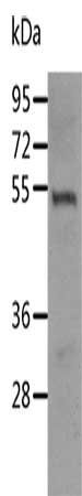 Gel: 10%SDS-PAGE, Lysate: 40 μg, Lane: Mouse thymus tissue, Primary antibody: RUNX3 Antibody(RUNX3 Antibody) at dilution 1/400, Secondary antibody: Goat anti rabbit IgG at 1/8000 dilution, Exposure time: 1 minuteRabbit anti-Human RUNX3 Polyclonal Antibody