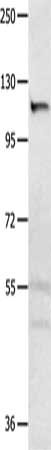 Gel: 8%SDS-PAGE, Lysate: 30 μg, Lane: Hela cells, Primary antibody: MSH3 Antibody(MSH3 Antibody) at dilution 1/250, Secondary antibody: Goat anti rabbit IgG at 1/8000 dilution, Exposure time: 1 second