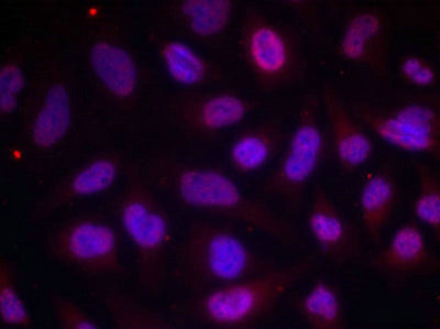 Immunofluorescence staining of methanol-fixed Hela cells using MEF2A(Phospho-Thr312) Antibody.