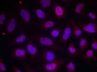 Immunofluorescence staining of methanol-fixed Hela cells using MEF2A(Phospho-Thr312) Antibody.