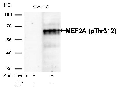 Western blot analysis of extracts from C2C12 cells, treated with Anisomycin or calf intestinal phosphatase (CIP), using MEF2A (Phospho-Thr312) Antibody.