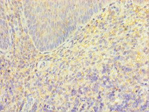 Immunohistochemistry of paraffin-embedded human tonsil tissue using TRPM2 Antibody at dilution of 1:100Rabbit anti-Human TRPM2 Polyclonal Antibody