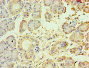 Immunohistochemistry of paraffin-embedded human pancreatic tissue using TRPM2 Antibody at dilution of 1:100Rabbit anti-Human TRPM2 Polyclonal Antibody