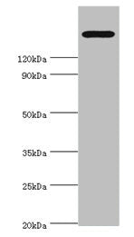 Western blot  | All lanes: TRPM2 antibody at 2µg/ml + K562 whole cell lysate  | Secondary  | Goat polyclonal to rabbit IgG at 1/10000 dilution  | Predicted band size: 172, 166, 96 kDa  | Observed band size: 172 kDaRabbit anti-Human TRPM2 Polyclonal Antibody