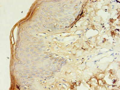 Immunohistochemistry of paraffin-embedded human skin tissue using TSPAN6 Antibody at dilution of 1:100