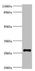 Western blot  | All lanes: TSPAN6 antibody at 20µg/ml + Mouse liver tissue  | Secondary  | Goat polyclonal to rabbit IgG at 1/10000 dilution  | Predicted band size: 28 kDa  | Observed band size: 28 kDa