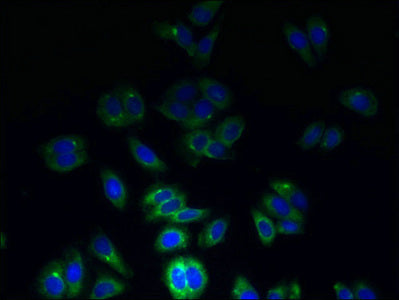 Immunofluorescent analysis of HepG2 cells using the antibody at dilution of 1:100 and Alexa Fluor 488-congugated AffiniPure Goat Anti-Rabbit IgG(H+L)Rabbit anti-Human TSPAN7 Polyclonal Antibody