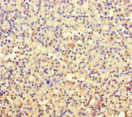 Immunohistochemistry of paraffin-embedded human spleen tissue using TSPAN7 Antibody at dilution of 1:100Rabbit anti-Human TSPAN7 Polyclonal Antibody