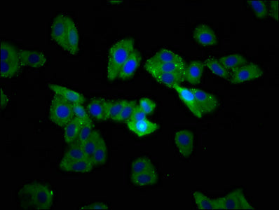 Immunofluorescence staining of HepG2 cells with TSPAN9 Antibody at 1:233, counter-stained with DAPI. The cells were fixed in 4% formaldehyde, permeabilized using 0.2% Triton X-100 and blocked in 10% normal Goat Serum. The cells were then incubated with the antibody overnight at 4°C. The secondary antibody was Alexa Fluor 488-congugated AffiniPure Goat Anti-Rabbit IgG(H+L).Rabbit anti-Human TSPAN9 Polyclonal Antibody