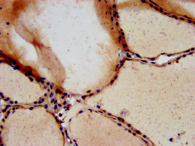 IHC image of the antibody diluted at 1:700 and staining in paraffin-embedded human thyroid tissue performed on a Leica BondTM system. After dewaxing and hydration, antigen retrieval was mediated by high pressure in a citrate buffer (pH 6.0). Section was blocked with 10% normal goat serum 30min at RT. Then primary antibody (1% BSA) was incubated at 4°C overnight. The primary is detected by a biotinylated secondary antibody and visualized using an HRP conjugated SP system.Rabbit anti-Human TSPAN9 Polyclonal Antibody