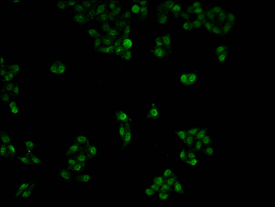 Immunofluorescence staining of Hela cells with POLR2A Antibody at 1:100, counter-stained with DAPI. The cells were fixed in 4% formaldehyde and blocked in 10% normal Goat Serum. The cells were then incubated with the antibody overnight at 4°C. The secondary antibody was Alexa Fluor 488-congugated AffiniPure Goat Anti-Rabbit IgG(H+L).Rabbit anti-Human POLR2A Polyclonal Antibody