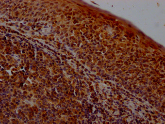 IHC image of the antibody diluted at 1:400 and staining in paraffin-embedded human tonsil tissue performed on a Leica BondTM system. After dewaxing and hydration, antigen retrieval was mediated by high pressure in a citrate buffer (pH 6.0). Section was blocked with 10% normal goat serum 30min at RT. Then primary antibody (1% BSA) was incubated at 4°C overnight. The primary is detected by a Goat anti-rabbit polymer IgG labeled by HRP and visualized using 0.05% DAB.Rabbit anti-Human POLR2A Polyclonal Antibody