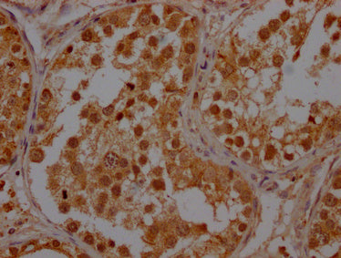 IHC image of POLR2A Antibody diluted at 1:400 and staining in paraffin-embedded human testis tissue performed on a Leica BondTM system. After dewaxing and hydration, antigen retrieval was mediated by high pressure in a citrate buffer (pH 6.0). Section was blocked with 10% normal goat serum 30min at RT. Then primary antibody (1% BSA) was incubated at 4°C overnight. The primary is detected by a Goat anti-rabbit polymer IgG labeled by HRP and visualized using 0.05% DAB.Rabbit anti-Human POLR2A Polyclonal Antibody