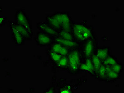 Immunofluorescent analysis of Hela cells using TTK Antibody at dilution of 1:100 and Alexa Fluor 488-congugated AffiniPure Goat Anti-Rabbit IgG(H+L)Rabbit anti-Human TTK Polyclonal Antibody