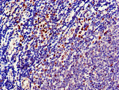 Immunohistochemistry of paraffin-embedded human lymph node tissue using the antibody at dilution of 1:100Rabbit anti-Human TTK Polyclonal Antibody