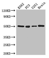 Western Blot  | Positive WB detected in: K562 whole cell lysate, PC-3 whole cell lysate, U251 whole cell lysate, Mouse brain tissue  | All lanes: TUBA1C antibody at 3μg/ml  | Secondary  | Goat polyclonal to rabbit IgG at 1/50000 dilution  | Predicted band size: 50 kDa  | Observed band size: 50 kDaRabbit anti-Human TUBA1C Polyclonal Antibody