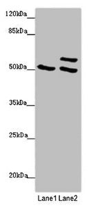 Western blot | All lanes: TUBB4A antibody at 2 μg/ml | Lane 1: 293T whole cell lysate | Lane 2: Hela whole cell lysate | Secondary | Goat polyclonal to rabbit IgG at 1/10000 dilution | Predicted band size: 50 kDa | Observed band size: 50, 58 kDaRabbit anti-Human TUBB4A Polyclonal Antibody