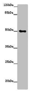 Western blot | All lanes: TUBG1 antibody at 14μg/ml + Hela whole cell lysate | Secondary | Goat polyclonal to rabbit IgG at 1/10000 dilution | Predicted band size: 52 kDa | Observed band size: 52 kDaRabbit anti-Human TUBG1 Polyclonal Antibody