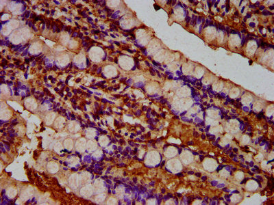 IHC image of TUSC3 Antibody diluted at 1:300 and staining in paraffin-embedded human small intestine tissue performed on a Leica BondTM system. After dewaxing and hydration, antigen retrieval was mediated by high pressure in a citrate buffer (pH 6.0). Section was blocked with 10% normal goat serum 30min at RT. Then primary antibody (1% BSA) was incubated at 4°C overnight. The primary is detected by a biotinylated secondary antibody and visualized using an HRP conjugated SP system.Rabbit anti-Human TUSC3 Polyclonal Antibody