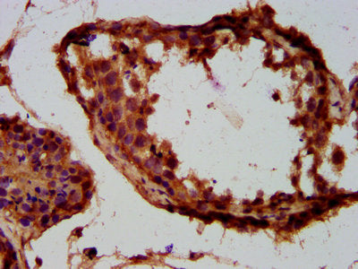 IHC image of TUSC3 Antibody diluted at 1:300 and staining in paraffin-embedded human testis tissue performed on a Leica BondTM system. After dewaxing and hydration, antigen retrieval was mediated by high pressure in a citrate buffer (pH 6.0). Section was blocked with 10% normal goat serum 30min at RT. Then primary antibody (1% BSA) was incubated at 4°C overnight. The primary is detected by a biotinylated secondary antibody and visualized using an HRP conjugated SP system.Rabbit anti-Human TUSC3 Polyclonal Antibody