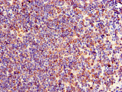 Immunohistochemistry of paraffin-embedded human lymph node tissue using TXK Antibody at dilution of 1:100Rabbit anti-Human TXK Polyclonal Antibody