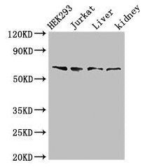 Western Blot  | Positive WB detected in: HEK293 whole cell lysate, Jurkat whole cell lysate, Rat liver tissue, Rat kidney tissue  | All lanes: TXK antibody at 3µg/ml  | Secondary  | Goat polyclonal to rabbit IgG at 1/50000 dilution  | Predicted band size: 62 kDa  | Observed band size: 62 kDaRabbit anti-Human TXK Polyclonal Antibody