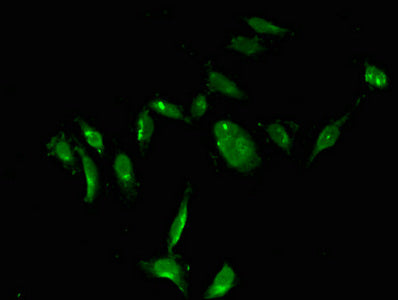 Immunofluorescent analysis of Hela cells using TYMS Antibody at dilution of 1:100 and Alexa Fluor 488-congugated AffiniPure Goat Anti-Rabbit IgG(H+L)Rabbit anti-Human TYMS Polyclonal Antibody