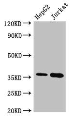 Western Blot  | Positive WB detected in: HepG2 whole cell lysate, Jurkat whole cell lysate  | All lanes: TYMS antibody at 2.4µg/ml  | Secondary  | Goat polyclonal to rabbit IgG at 1/50000 dilution  | Predicted band size: 36, 32, 27 kDa  | Observed band size: 36 kDaRabbit anti-Human TYMS Polyclonal Antibody