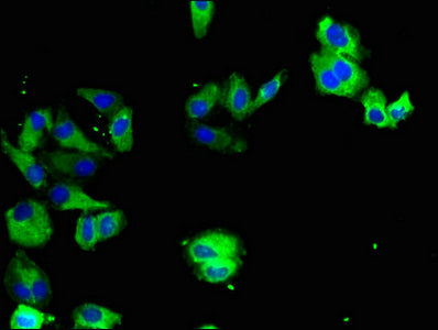 Immunofluorescent analysis of HepG2 cells using TYRO3 Antibody at dilution of 1:100 and Alexa Fluor 488-congugated AffiniPure Goat Anti-Rabbit IgG(H+L)Rabbit anti-Human TYRO3 Polyclonal Antibody