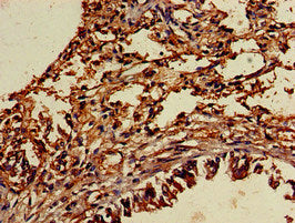 Immunohistochemistry of paraffin-embedded human lung tissue using the antibody at dilution of 1:100Rabbit anti-Human TYRO3 Polyclonal Antibody