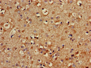 Immunohistochemistry of paraffin-embedded human brain tissue using TYRO3 Antibody at dilution of 1:100Rabbit anti-Human TYRO3 Polyclonal Antibody