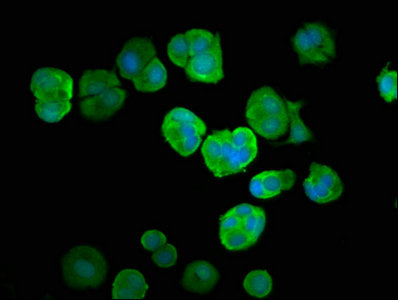 Immunofluorescence staining of MCF-7 cells with UBA52 Antibody at 1:66, counter-stained with DAPI. The cells were fixed in 4% formaldehyde, permeabilized using 0.2% Triton X-100 and blocked in 10% normal Goat Serum. The cells were then incubated with the antibody overnight at 4°C. The secondary antibody was Alexa Fluor 488-congugated AffiniPure Goat Anti-Rabbit IgG(H+L).Rabbit anti-Human UBA52 Polyclonal Antibody