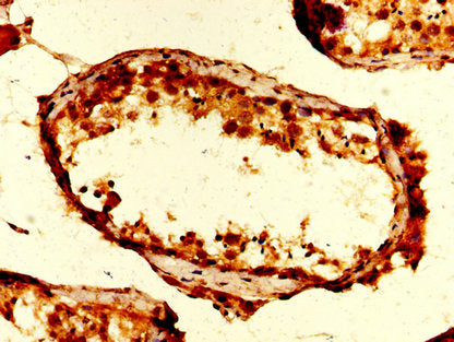 IHC image of the antibody diluted at 1:200 and staining in paraffin-embedded human testis tissue performed on a Leica BondTM system. After dewaxing and hydration, antigen retrieval was mediated by high pressure in a citrate buffer (pH 6.0). Section was blocked with 10% normal goat serum 30min at RT. Then primary antibody (1% BSA) was incubated at 4°C overnight. The primary is detected by a biotinylated secondary antibody and visualized using an HRP conjugated SP system.Rabbit anti-Human UBA52 Polyclonal Antibody