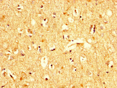 IHC image of UBA52 Antibody diluted at 1:200 and staining in paraffin-embedded human brain tissue performed on a Leica BondTM system. After dewaxing and hydration, antigen retrieval was mediated by high pressure in a citrate buffer (pH 6.0). Section was blocked with 10% normal goat serum 30min at RT. Then primary antibody (1% BSA) was incubated at 4°C overnight. The primary is detected by a biotinylated secondary antibody and visualized using an HRP conjugated SP system.Rabbit anti-Human UBA52 Polyclonal Antibody