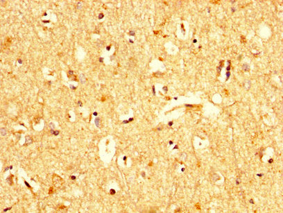 IHC image of UBA52 Antibody diluted at 1:200 and staining in paraffin-embedded human brain tissue performed on a Leica BondTM system. After dewaxing and hydration, antigen retrieval was mediated by high pressure in a citrate buffer (pH 6.0). Section was blocked with 10% normal goat serum 30min at RT. Then primary antibody (1% BSA) was incubated at 4°C overnight. The primary is detected by a biotinylated secondary antibody and visualized using an HRP conjugated SP system.Rabbit anti-Human UBA52 Polyclonal Antibody