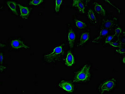 Immunofluorescent analysis of Hela cells using UBA6 Antibody at dilution of 1:100 and Alexa Fluor 488-congugated AffiniPure Goat Anti-Rabbit IgG(H+L)Rabbit anti-Human UBA6 Polyclonal Antibody