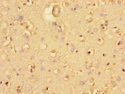 Immunohistochemistry of paraffin-embedded human brain tissue using the antibody at dilution of 1:100Rabbit anti-Human UBA6 Polyclonal Antibody
