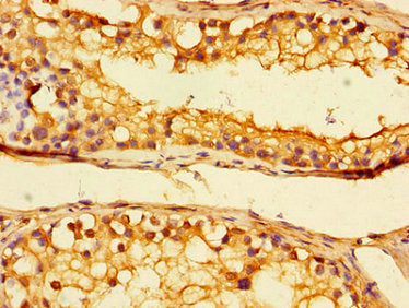 Immunohistochemistry of paraffin-embedded human testis tissue using UBA6 Antibody at dilution of 1:100Rabbit anti-Human UBA6 Polyclonal Antibody