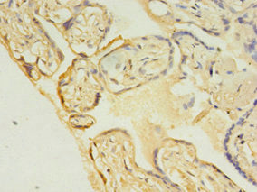 Immunohistochemistry of paraffin-embedded human placenta tissue using UBE2C Antibody at dilution of 1:100Rabbit anti-Human UBE2C Polyclonal Antibody