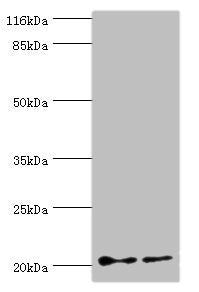 Western blot  | All lanes: UBE2C antibody at 2µg/ml  | Lane 1: Hela whole cell lysate  | Lane 2: U87 whole cell lysate  | Secondary  | Goat polyclonal to rabbit IgG at 1/10000 dilution  | Predicted band size: 20, 16, 17, 18 kDa  | Observed band size: 20 kDaRabbit anti-Human UBE2C Polyclonal Antibody