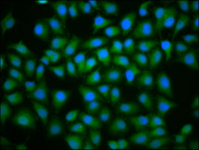 Immunofluorescence staining of Hela cells with UBE2D2 Antibody at 1:100, counter-stained with DAPI. The cells were fixed in 4% formaldehyde, permeabilized using 0.2% Triton X-100 and blocked in 10% normal Goat Serum. The cells were then incubated with the antibody overnight at 4°C. The secondary antibody was Alexa Fluor 488-congugated AffiniPure Goat Anti-Rabbit IgG(H+L).Rabbit anti-Human UBE2D2 Polyclonal Antibody