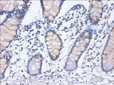 Immunohistochemistry of paraffin-embedded human small intestine tissue using HNRNPD Antibody at dilution of 1:100Rabbit anti-Human HNRNPD Polyclonal Antibody