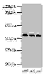 Western blot  | All lanes: HNRNPD antibody at 2µg/ml  | Lane 1: 293T whole cell lysate  | Lane 2: Hela whole cell lysate  | Lane 3: Jurkat whole cell lysate  | Secondary  | Goat polyclonal to rabbit IgG at 1/10000 dilution  | Predicted band size: 39, 37, 33, 31 kDa  | Observed band size: 39 kDaRabbit anti-Human HNRNPD Polyclonal Antibody