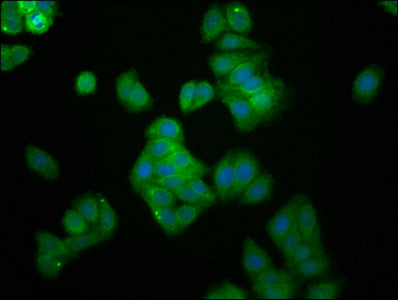 Immunofluorescence staining of HepG2 cells with UBE2G1 Antibody at 1:166, counter-stained with DAPI. The cells were fixed in 4% formaldehyde, permeabilized using 0.2% Triton X-100 and blocked in 10% normal Goat Serum. The cells were then incubated with the antibody overnight at 4°C. The secondary antibody was Alexa Fluor 488-congugated AffiniPure Goat Anti-Rabbit IgG(H+L).Rabbit anti-Human UBE2G1 Polyclonal Antibody