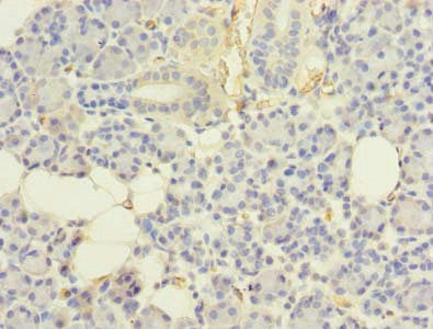 Immunohistochemistry of paraffin-embedded human pancreatic tissue using UBE2G2 Antibody at dilution of 1:100Rabbit anti-Human UBE2G2 Polyclonal Antibody
