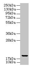 Western blot  | All lanes: UBE2G2 antibody at 8µg/ml + K562 whole cell lysate  | Secondary  | Goat polyclonal to rabbit IgG at 1/10000 dilution  | Predicted band size: 19, 16 kDa  | Observed band size: 19 kDaRabbit anti-Human UBE2G2 Polyclonal Antibody