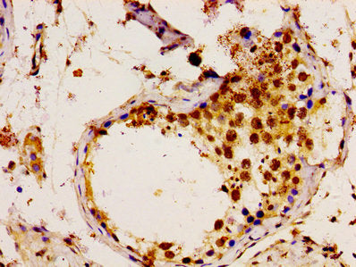 Immunohistochemistry of paraffin-embedded human testis tissue using UBE2L3 Antibody at dilution of 1:100Rabbit anti-Human UBE2L3 Polyclonal Antibody